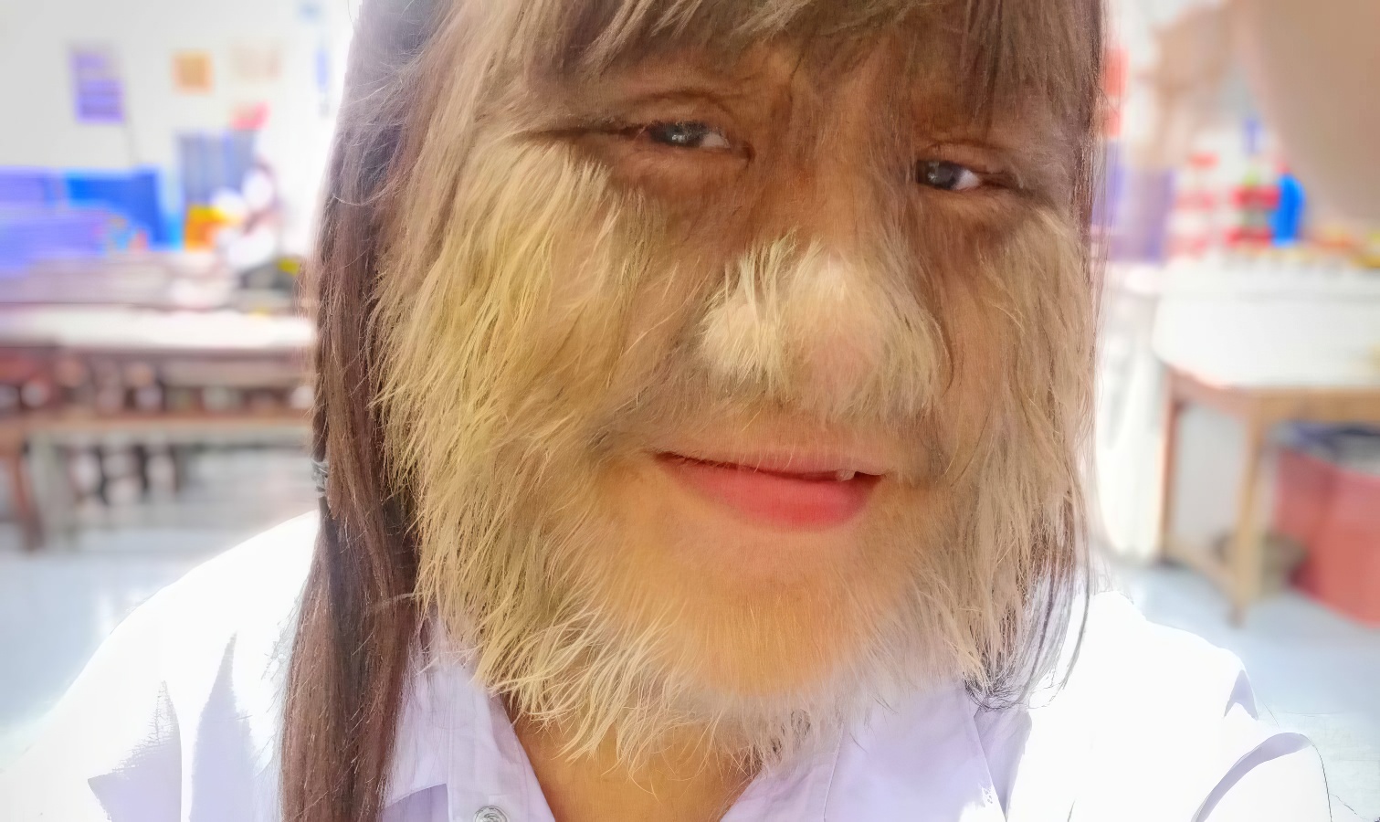 L&rsquo;adolescente la plus poilue du monde s’est rasé le visage après avoir obtenu un record Guinness