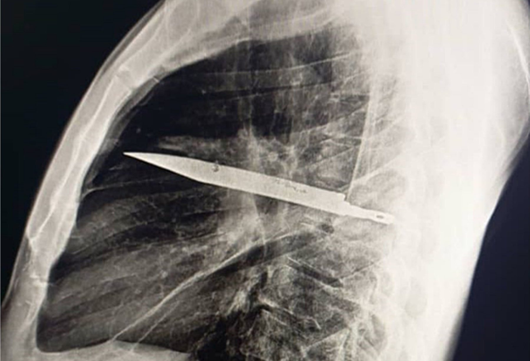 Le choc de la découverte à l'hôpital