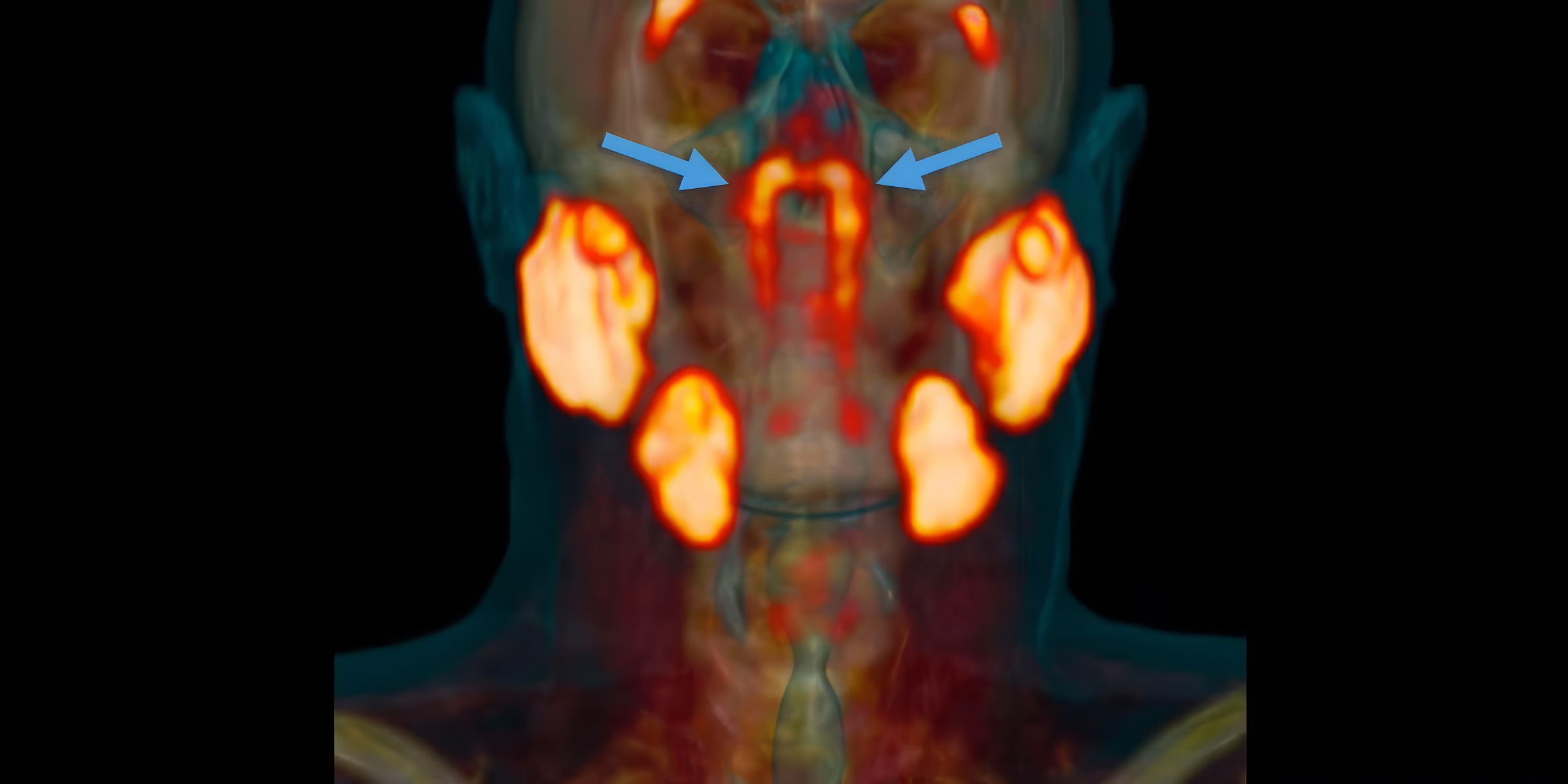 Bienvenue aux 'glandes salivaires tubaires'