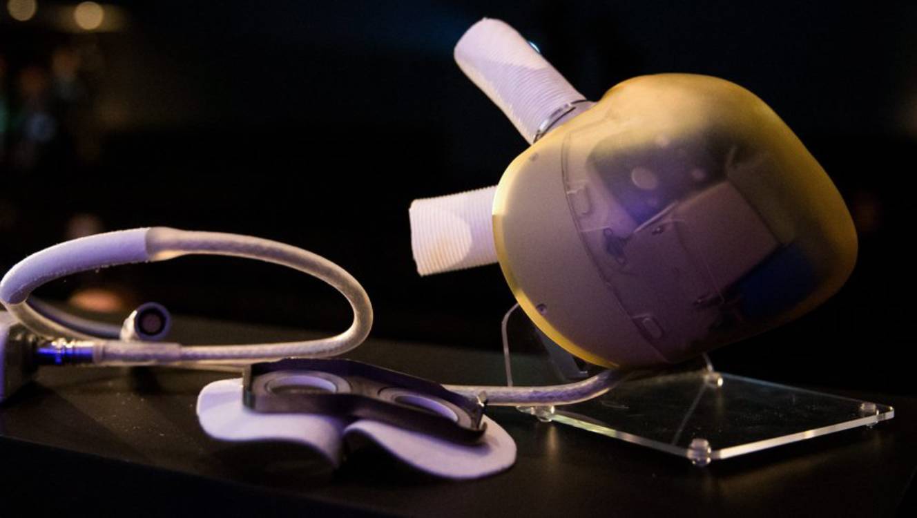 Conclusion : un trésor technologique en danger