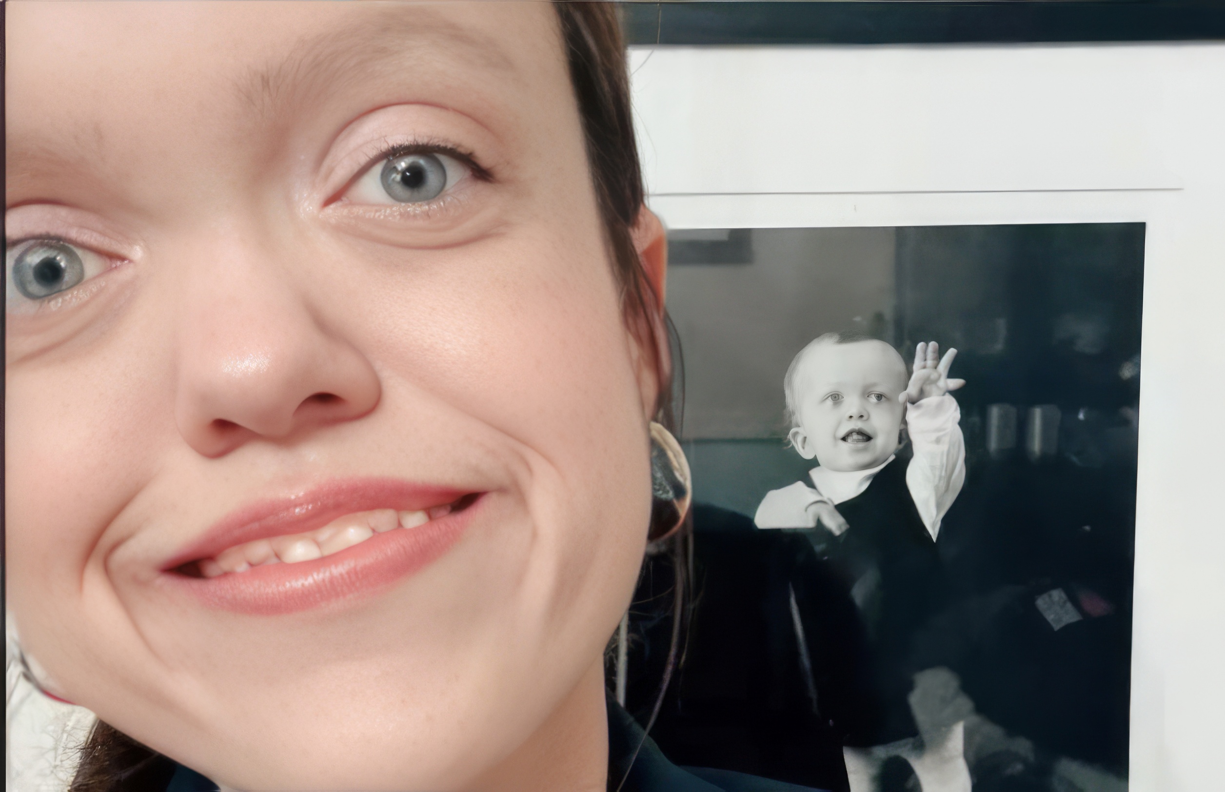 Vivre avec l'achondroplasie : un défi de tous les jours