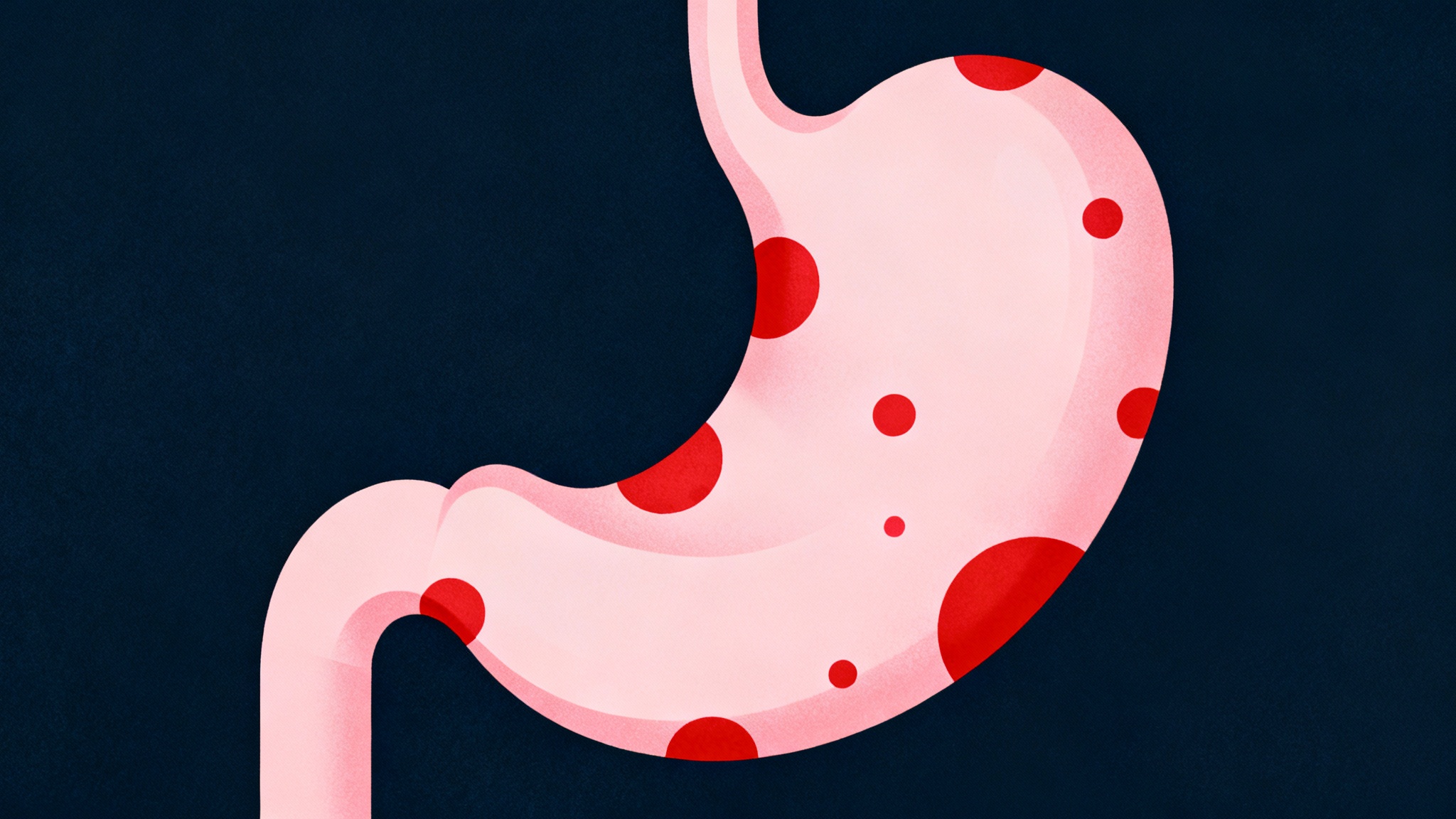 Quand la bactérie se réveille et devient un problème