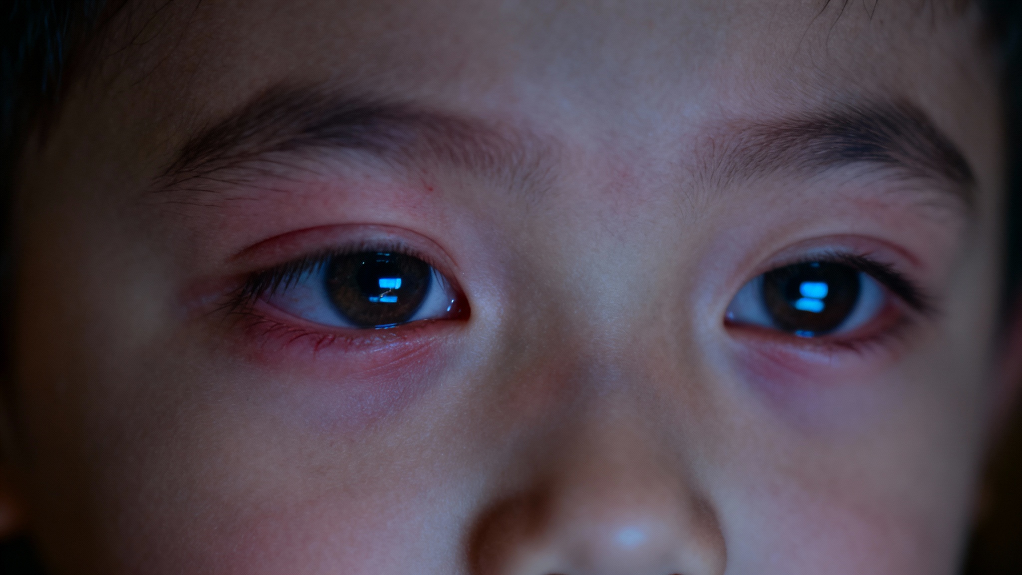 Ce trouble visuel que l&rsquo;on confond avec de l&rsquo;hyperactivité chez les enfants surexposés aux écrans