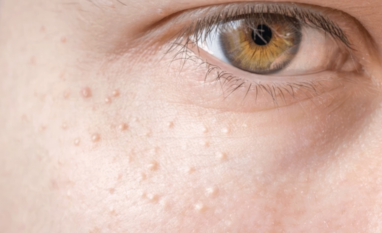 Qu'est-ce que c'est, exactement ? Les grains de milium