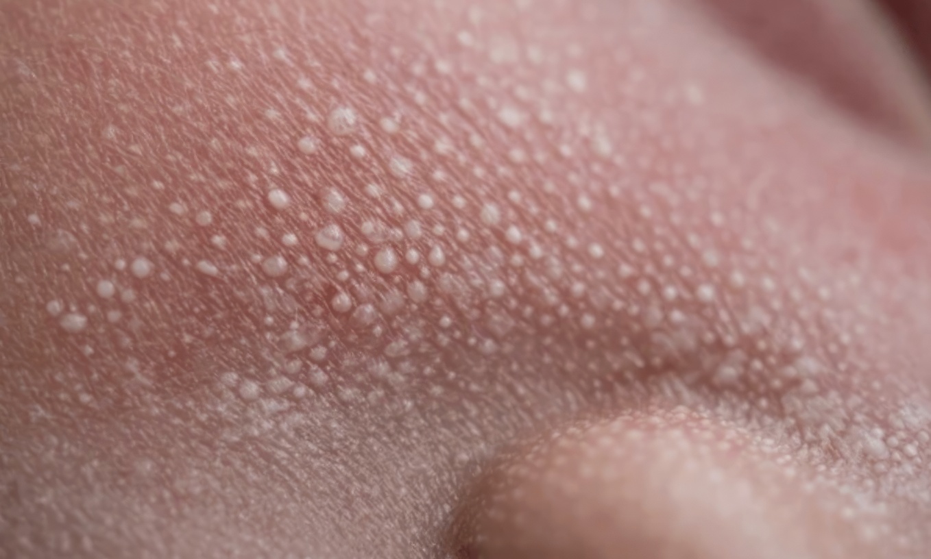 Qui est concerné et où apparaissent-ils ?