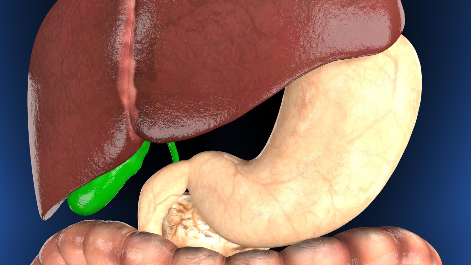 Un cancer silencieux, mais redoutable en chiffres