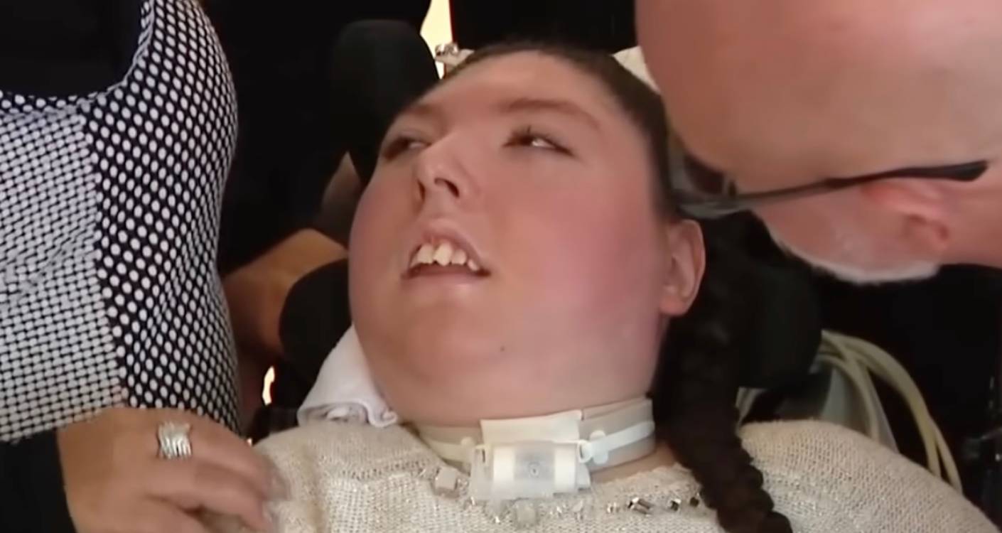 Une femme née sans cerveau fête ses 20 ans : l’incroyable histoire d’Alex Simpson