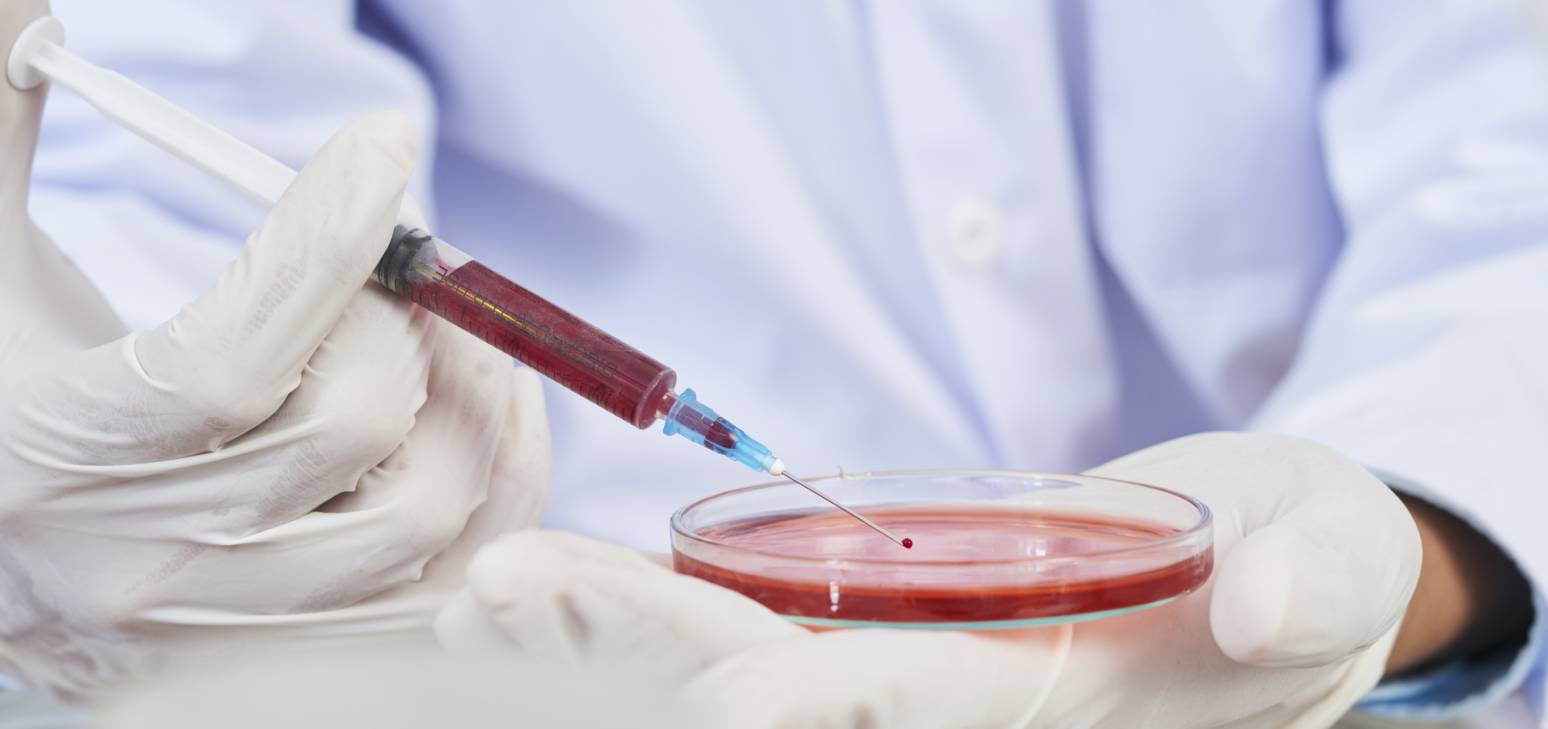 Sida : comprendre les symptômes alors que 3,3 millions de nouveaux cas inquiètent les experts