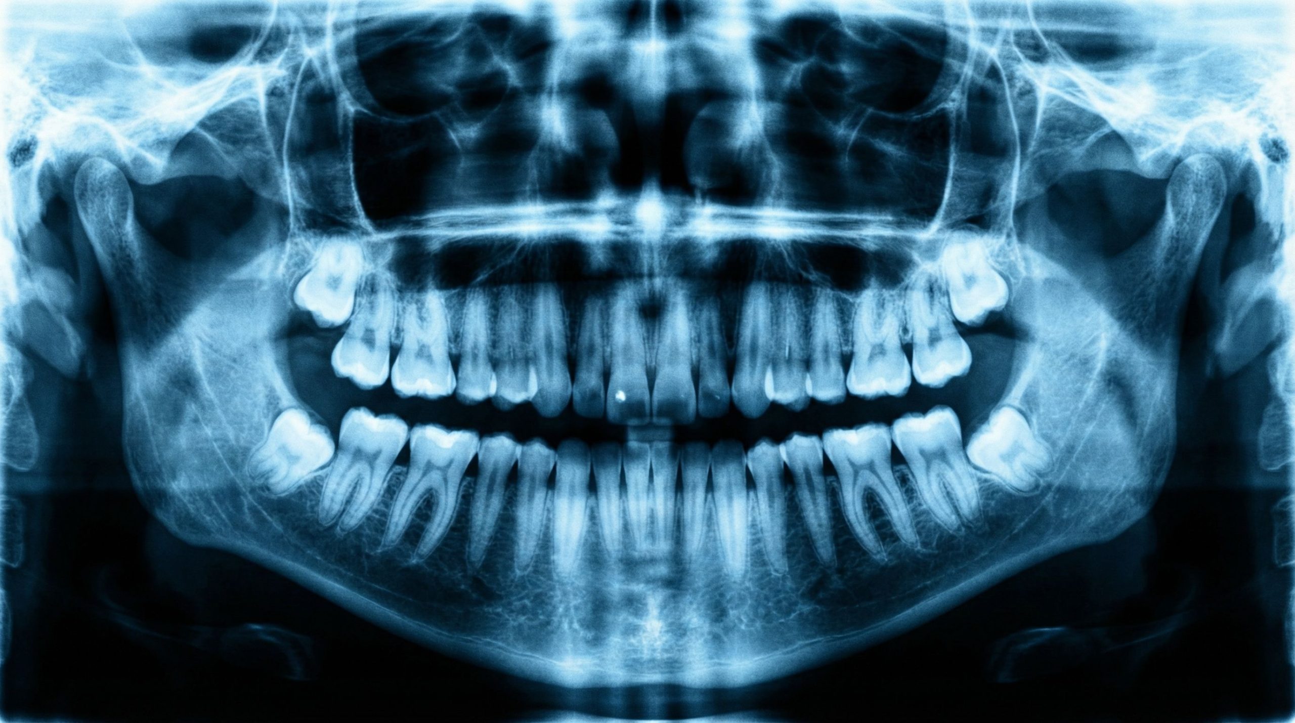 Ce que vos dents révèlent sur votre espérance de vie (et c’est assez effrayant)
