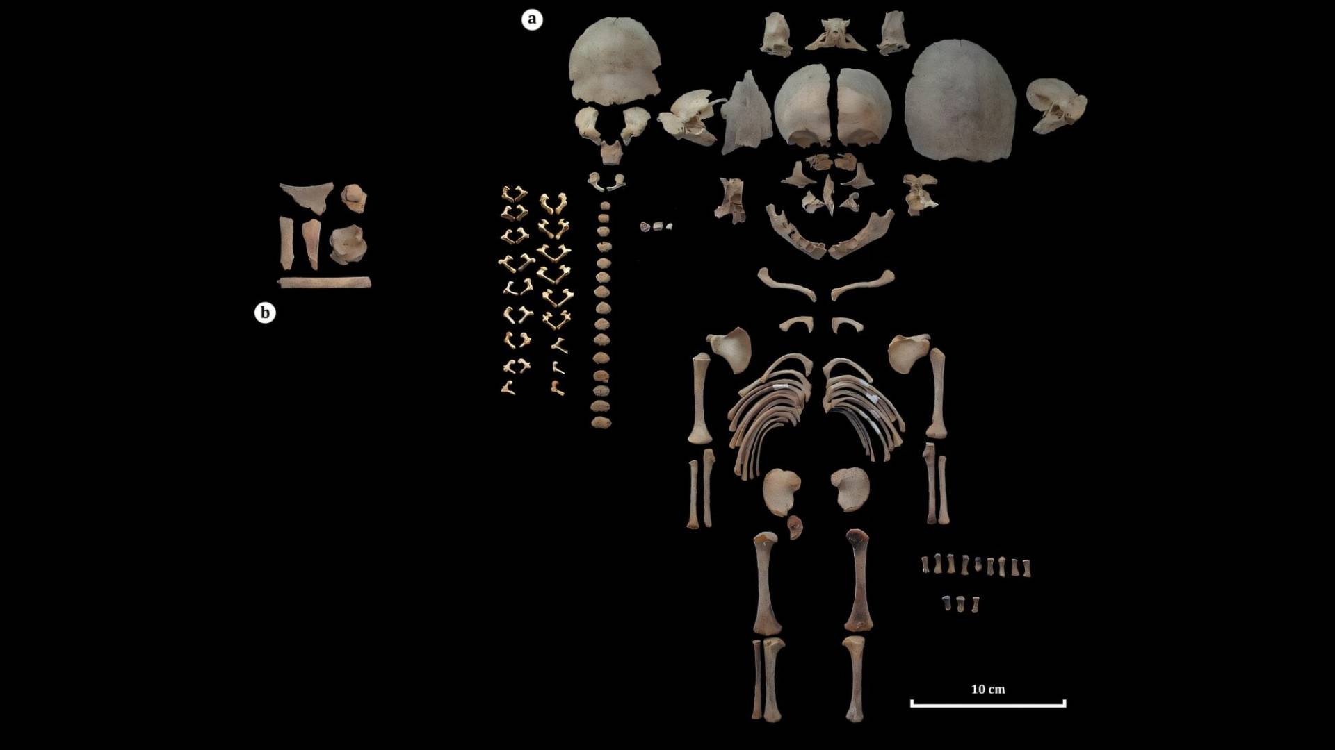 Mystère en Iran : pourquoi ces deux fœtus d'il y a 6500 ans ont-ils été traités si différemment ?