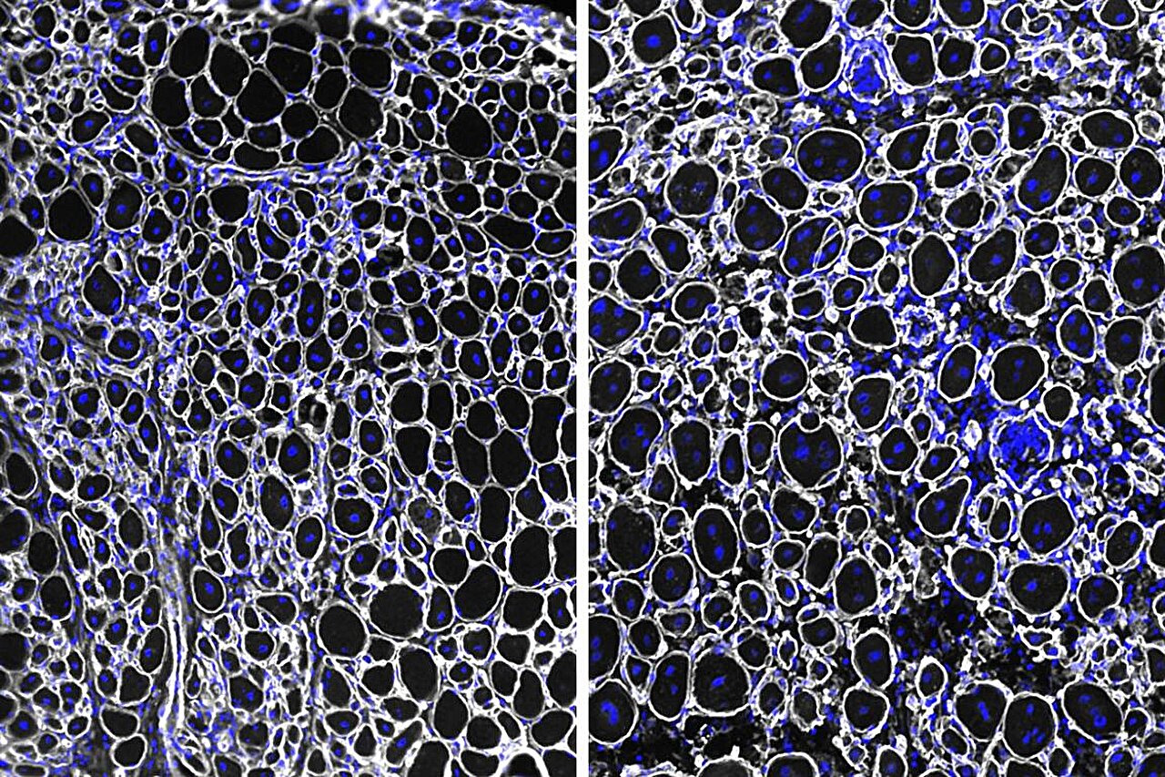 Sprint ou marathon ? Les cellules souches musculaires vieillissantes passent de la réparation rapide à la survie à long terme
