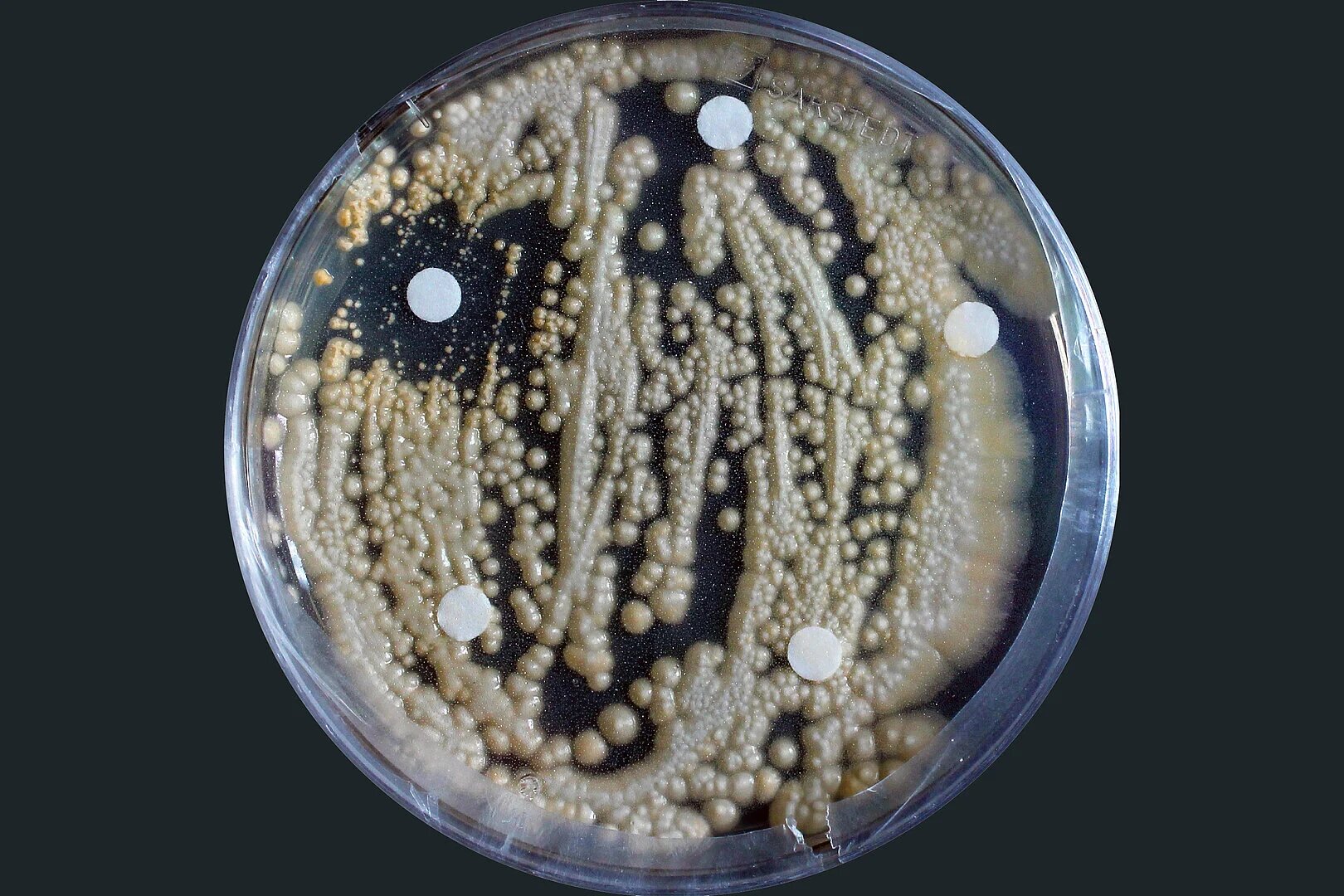 À surveiller alors que les infections fongiques augmentent : des espèces capables d’activer rapidement des protéines utilisant les graisses