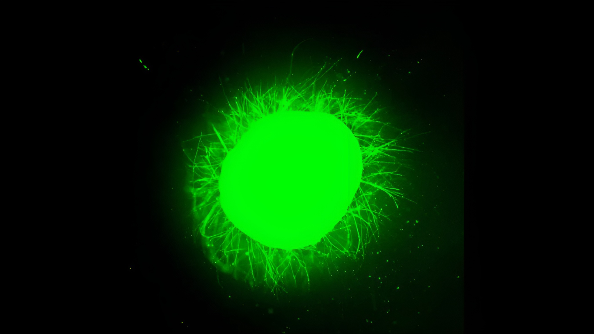 Des « mini » moelles épinières humaines cultivées en laboratoire marquent une avancée majeure vers la guérison de la paralysie