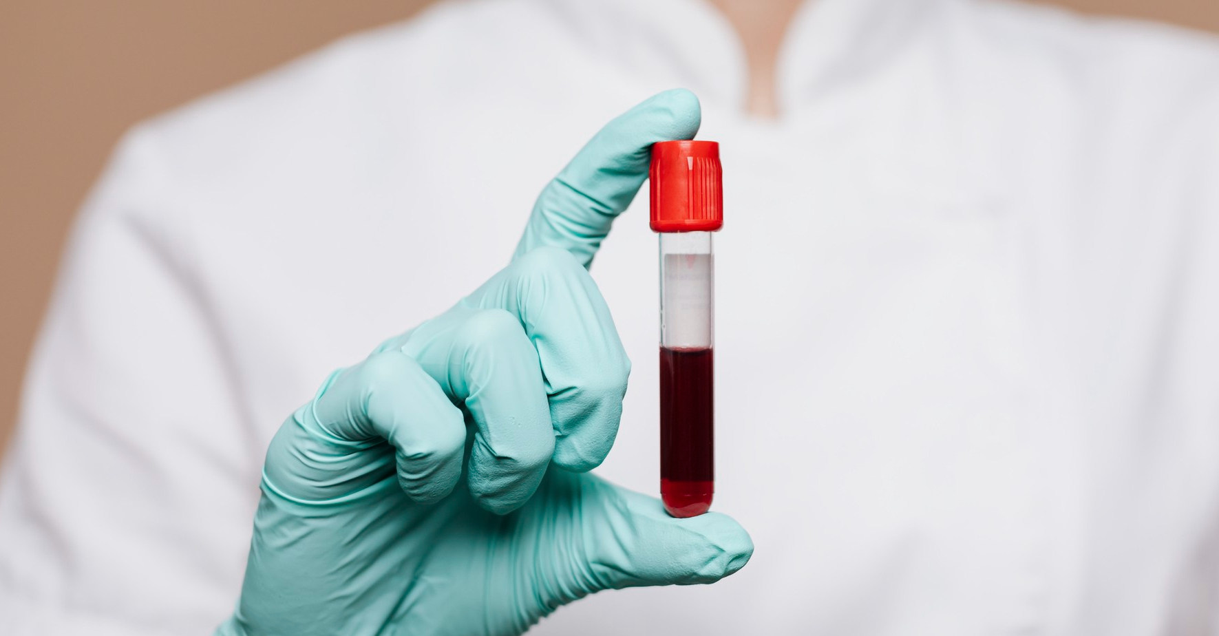 Le groupe sanguin avec le plus faible risque de cancer révélé par les médecins