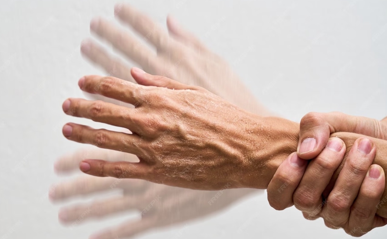 Des scientifiques ont trouvé une nouvelle cause de la maladie de Parkinson et expliquent l’augmentation des diagnostics