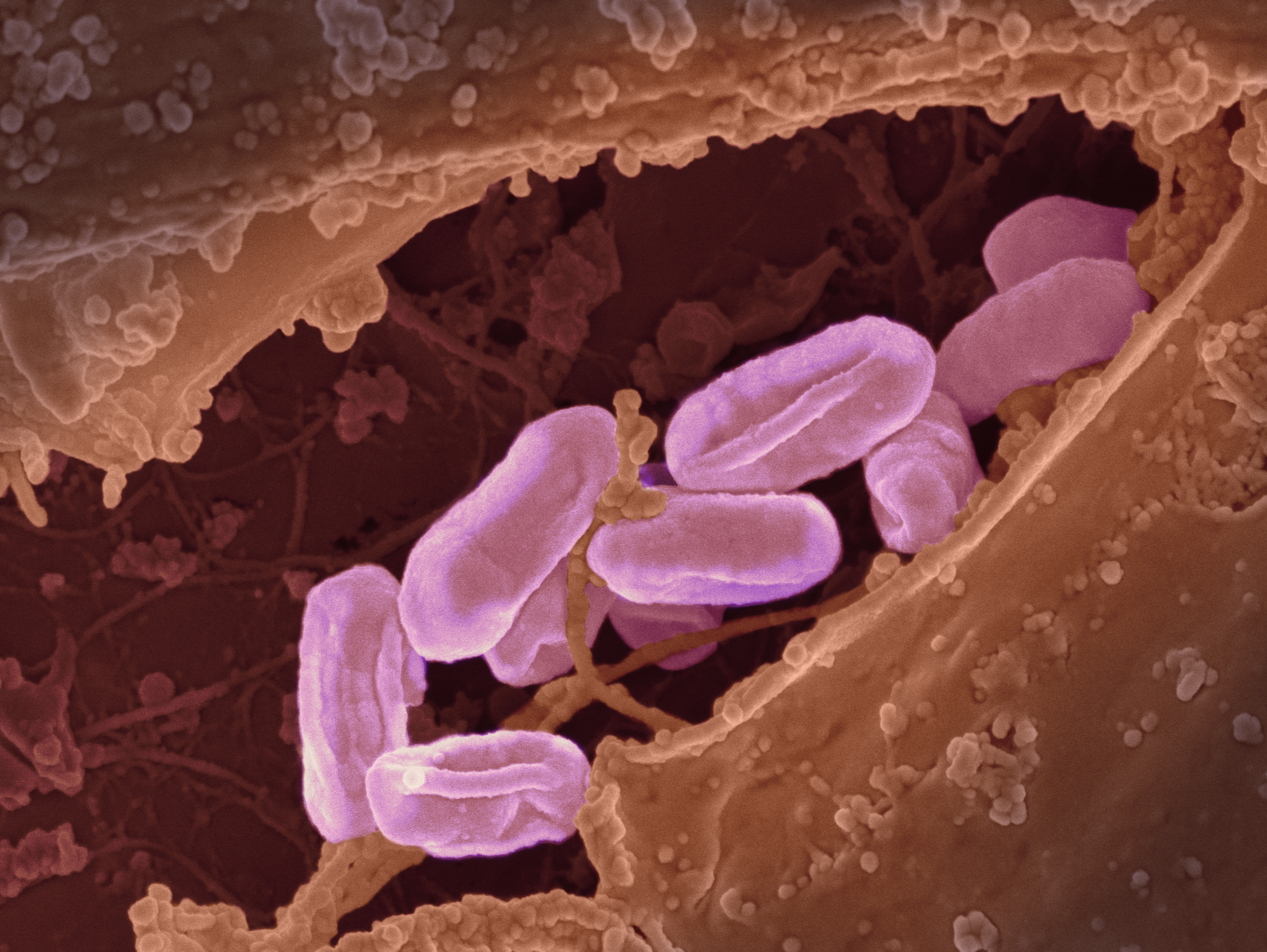 Des cas de typhus battent des records à Los Angeles : le lien avec nos animaux de compagnie