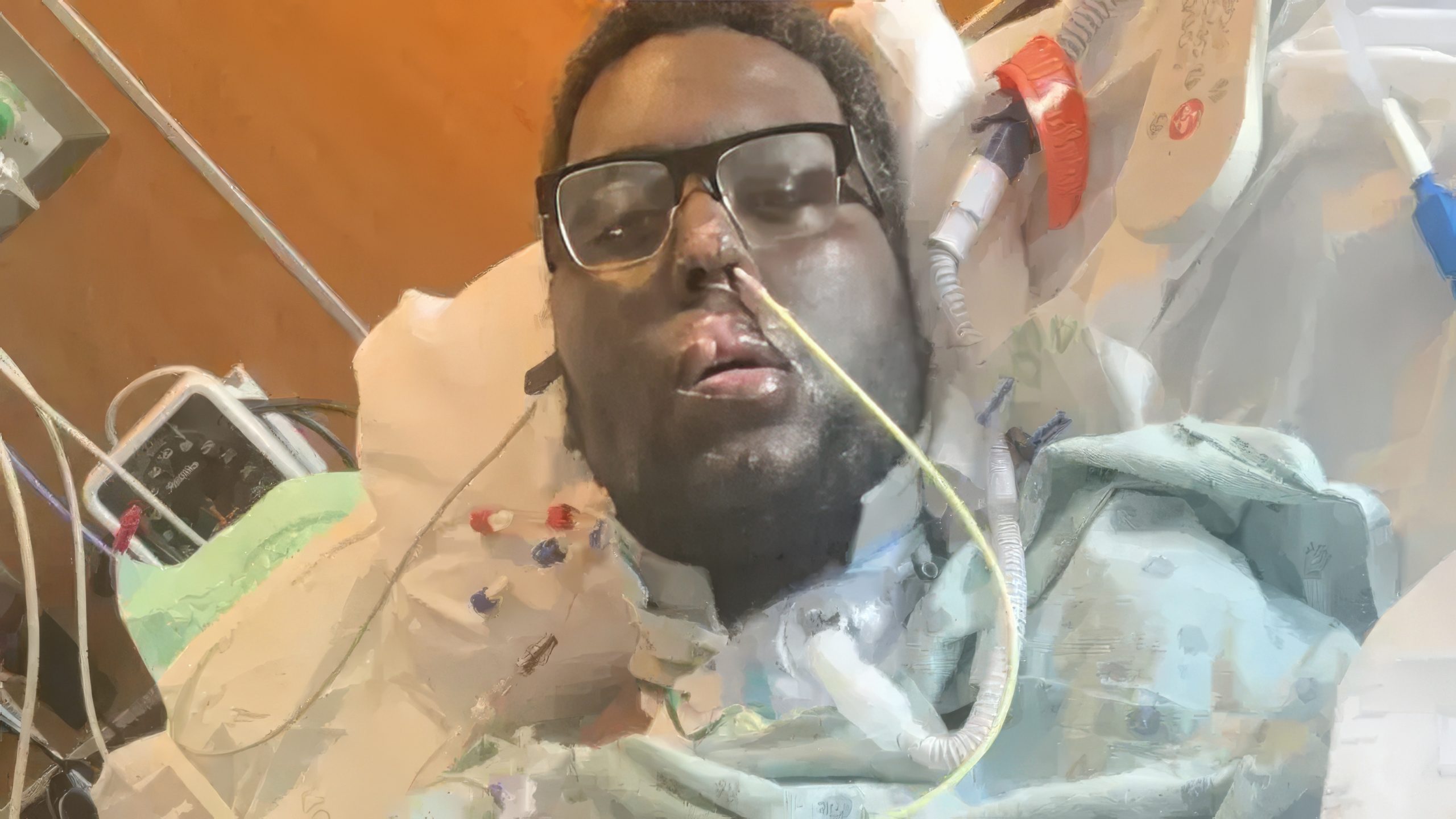 Un homme de 34 ans perd ses 4 membres après une infection grave survenue après un soin dentaire