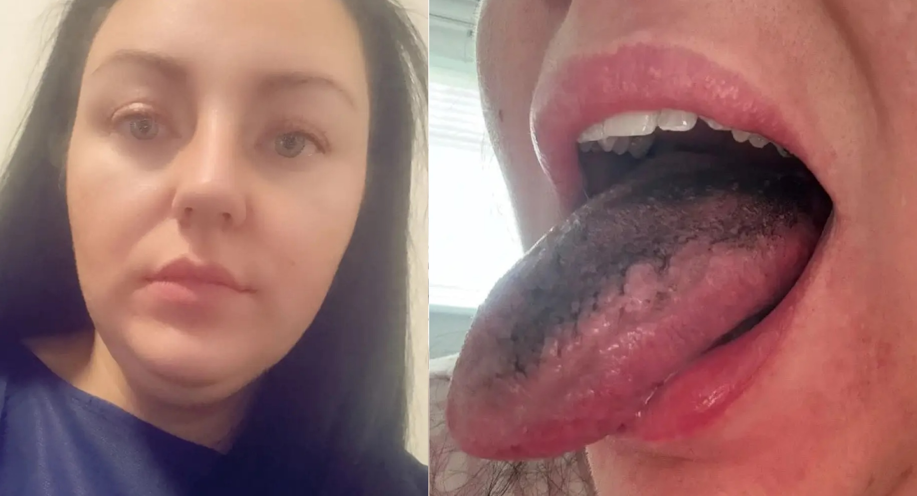 Une femme décrit des effets secondaires d’un médicament amaigrissant