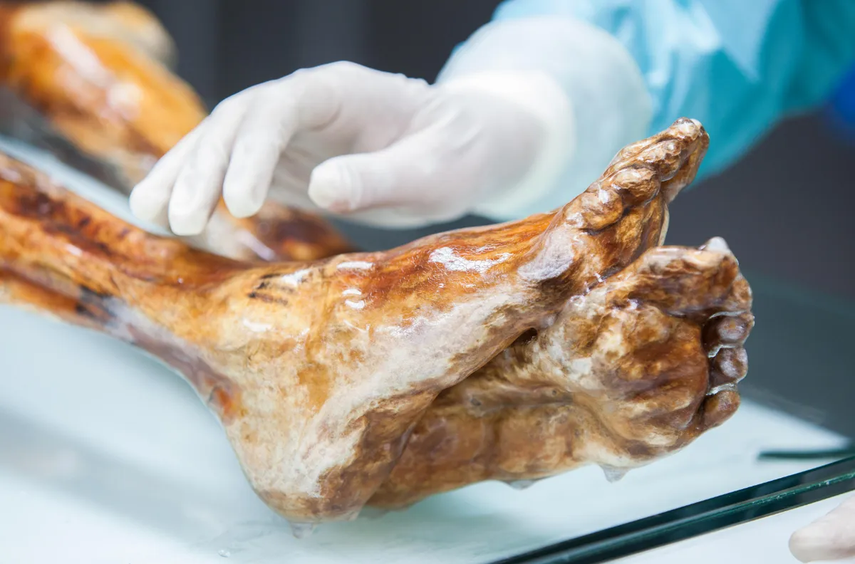 Des microbes vieux de 5 300 ans prélevés sur la momie Ötzi reprennent vie en laboratoire
